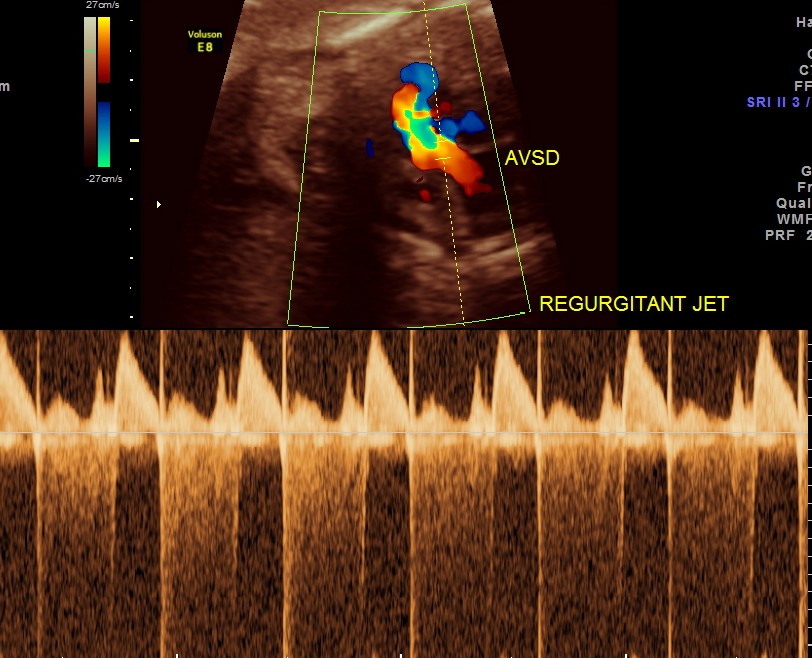 IMG_20130329_1 RUKMANI