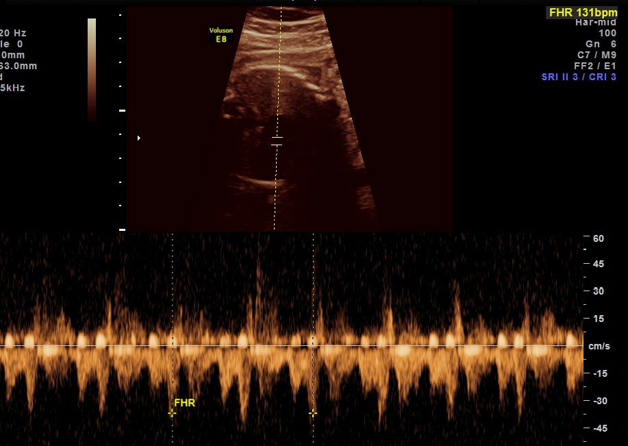 this shows a normal conduction and rate