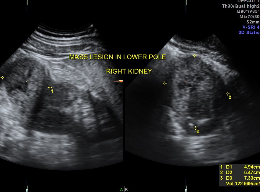 the solid mass has a volume of around 122 cc