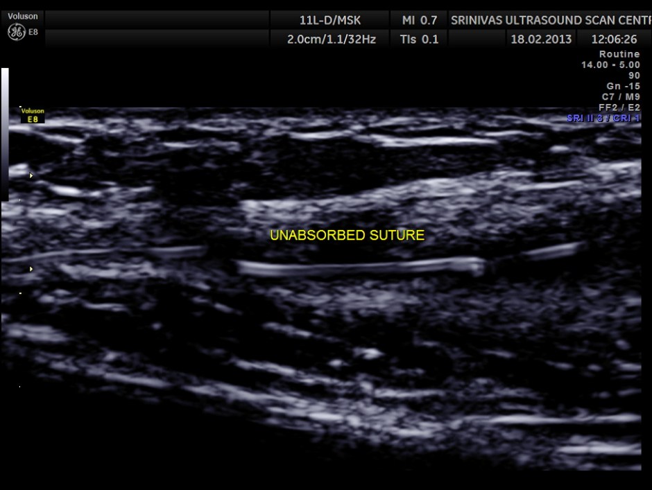 PARIETAL COLLECTION_1