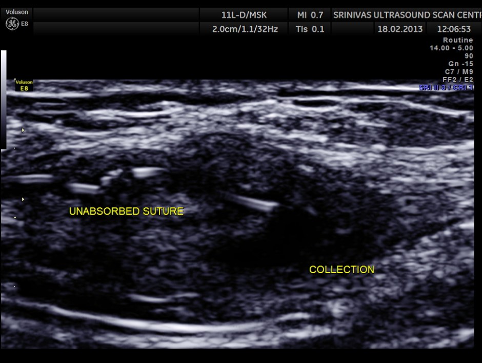 PARIETAL COLLECTION_2