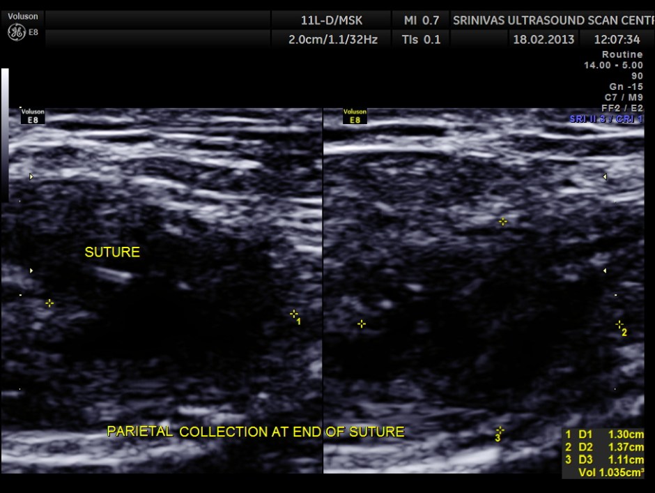 PARIETAL COLLECTION_3