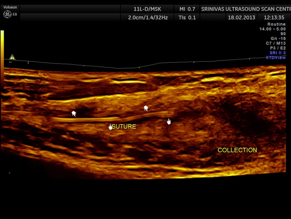PARIETAL COLLECTION_4