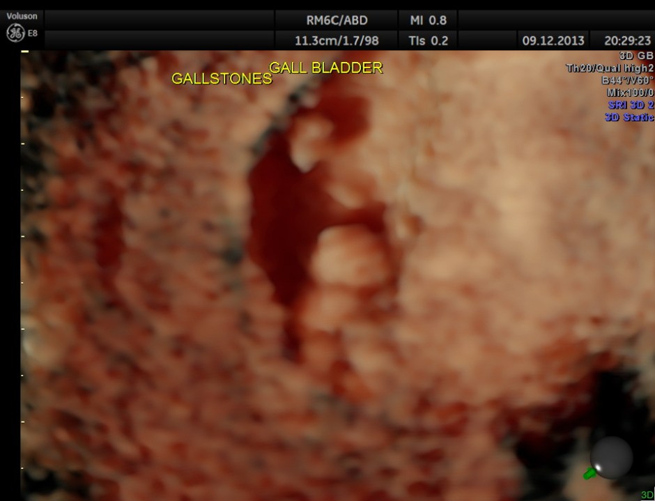 what would be the count now ?