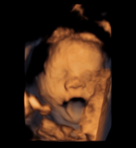 BABY YAWN_2