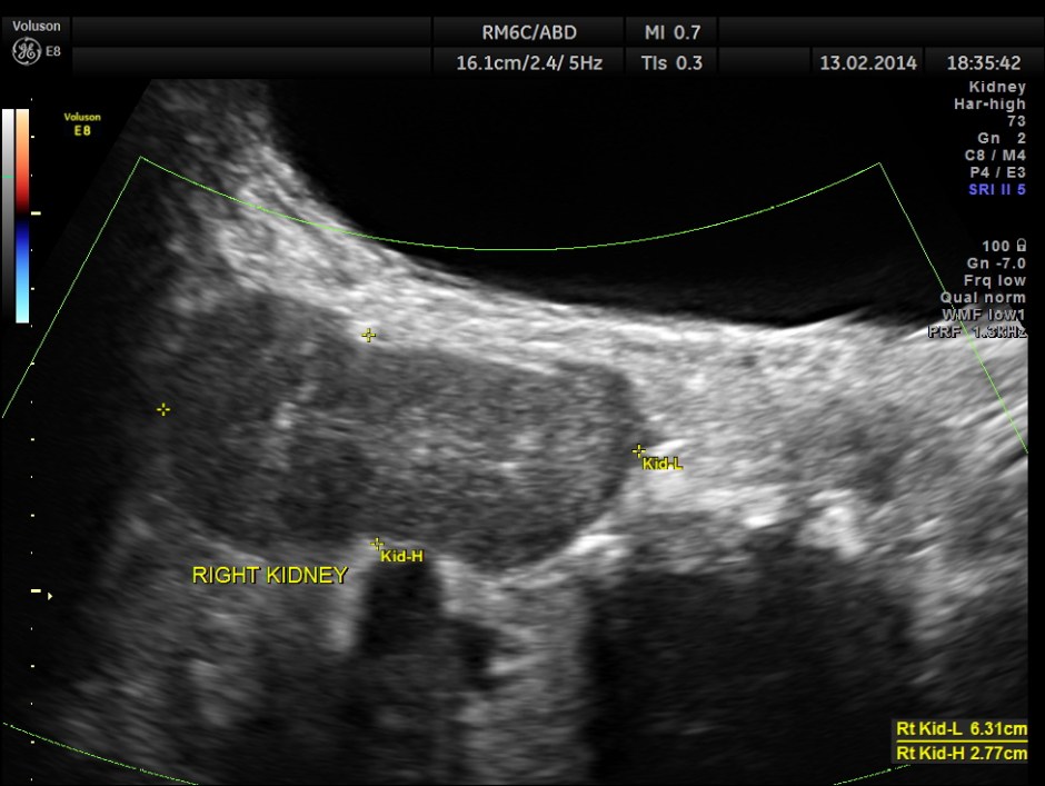 HORSE SHOE KIDNEY ADULT_13