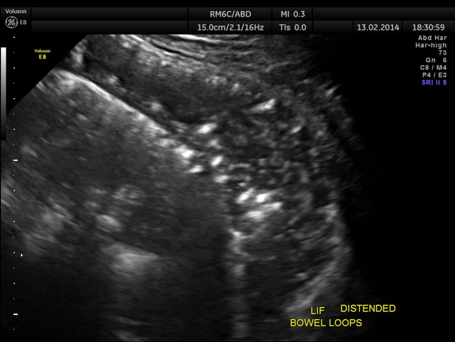 HORSE SHOE KIDNEY ADULT_5