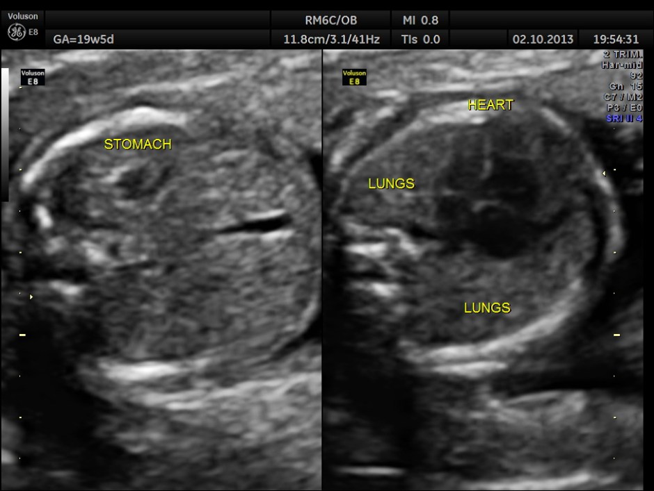 CO ARCTATION OF AO_11