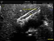 GB DYSFUNCTION_3